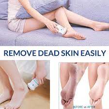 Buy Rechargeable Callus Remover - Get Clear Heels